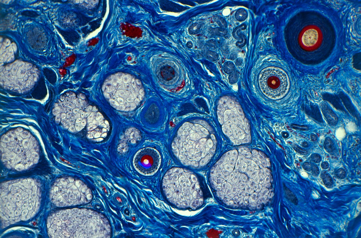 Peau humaine vue au microscope, montrant la tige du cheveu et les pores sudoripares - Unknown