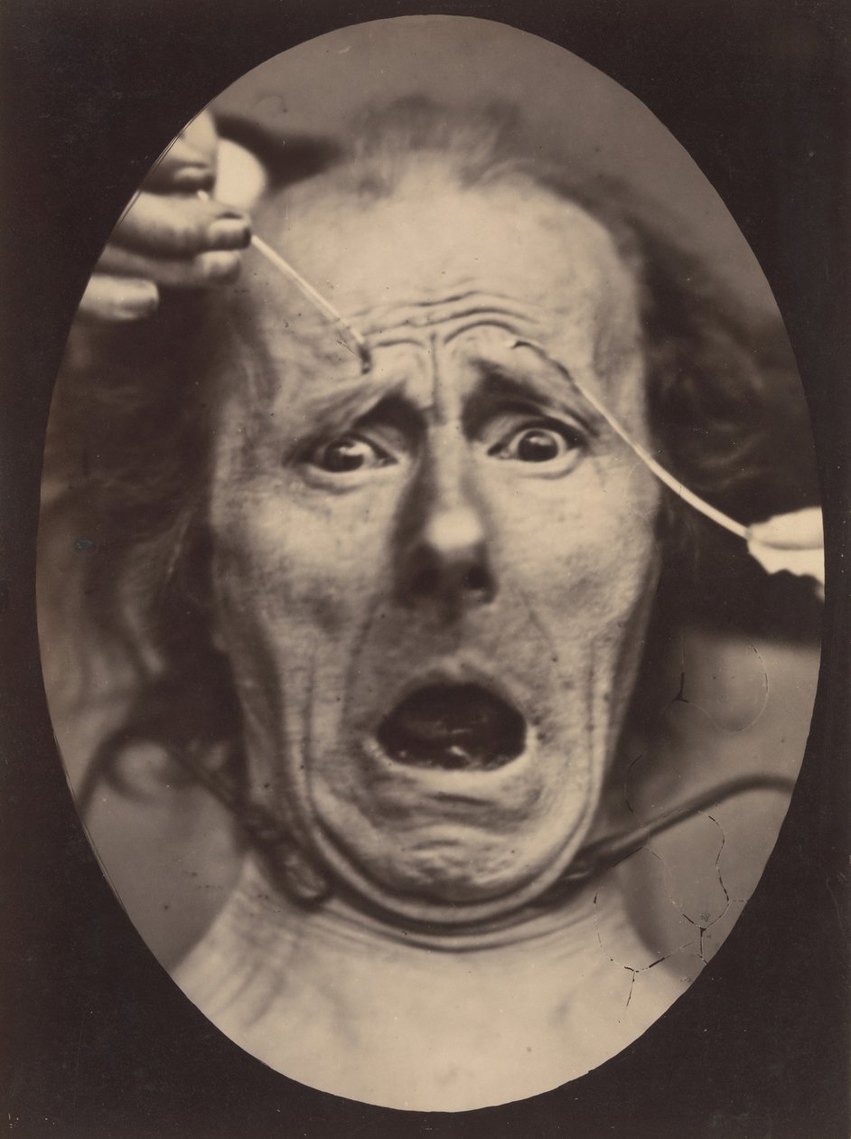 Électro-Physiologie, Figure 64, 1854-56, imprimé en 1862 - Adrien Alban Tournachon