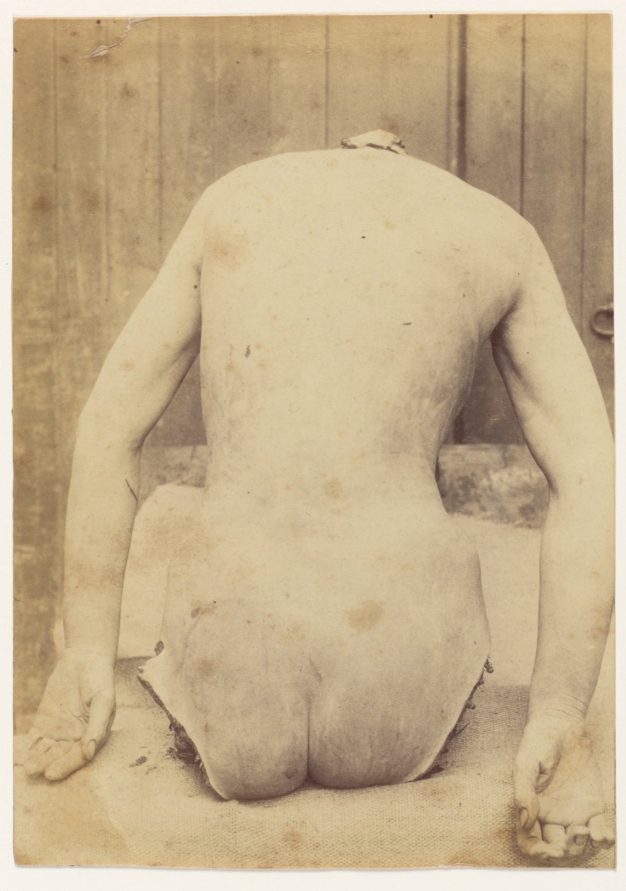 Vue de dos du Tronc - Alphonse Bertillon