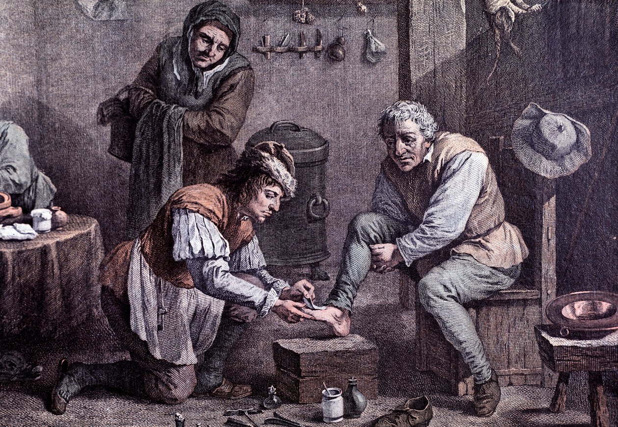 Une opération chirurgicale (gravure) - Anonymous Anonymous