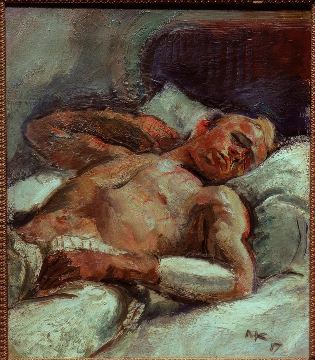 Blessé - Anton Kolig