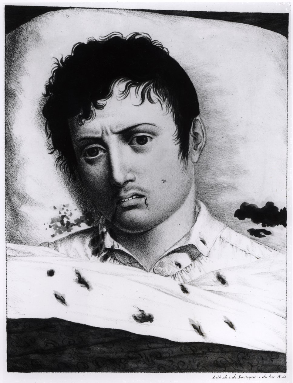 Observation de la fièvre jaune, c.1819 - Charles Lasteyrie du Saillant