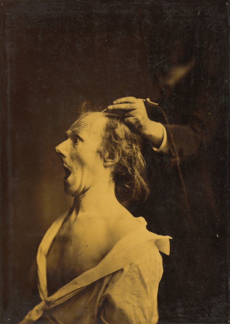 Étonnement, stupéfaction, émerveillement, 1854-1856, imprimé 1862 - Duchenne de Boulogne