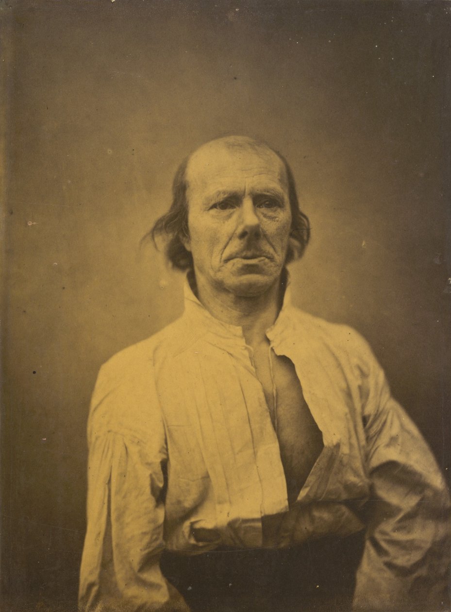 Visage au repos - Duchenne de Boulogne