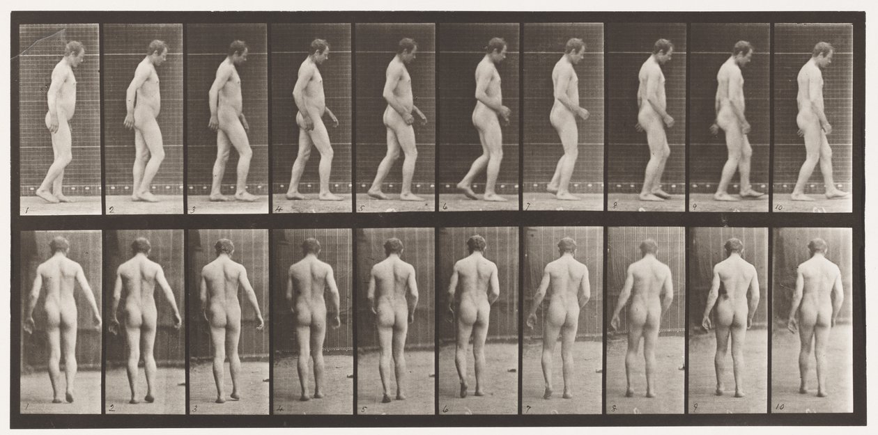 Planche 553. Après traumatisme crânien ; marche - Eadweard Muybridge