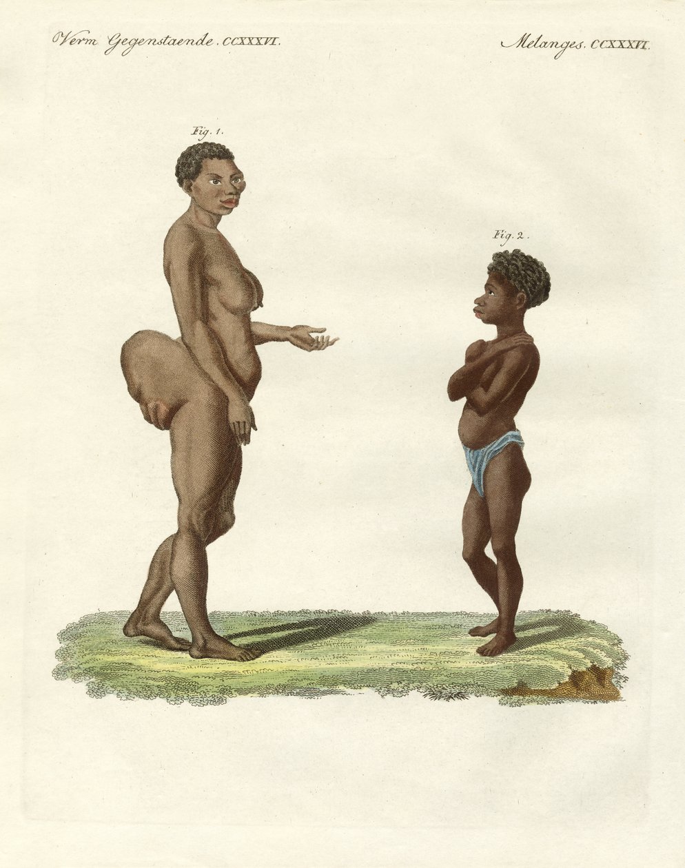 Variétés humaines étranges - German School