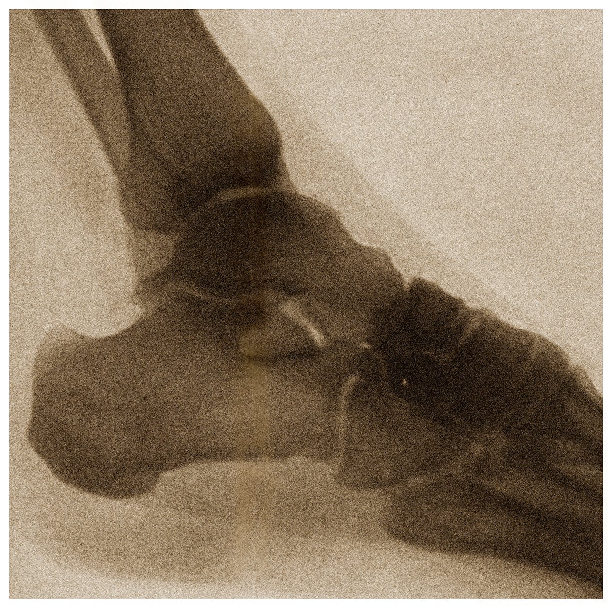 Radiographie d