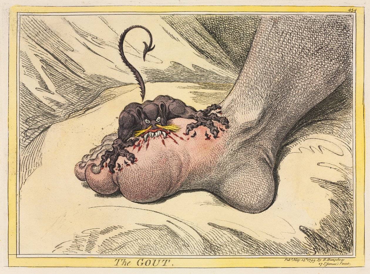 La goutte - James Gillray