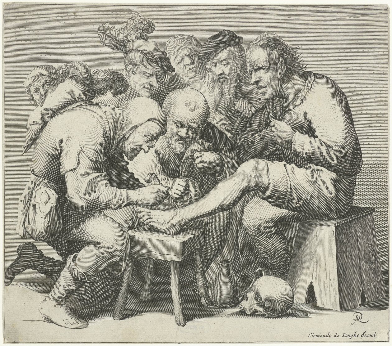 Opération du pied - Pieter Jansz Quast