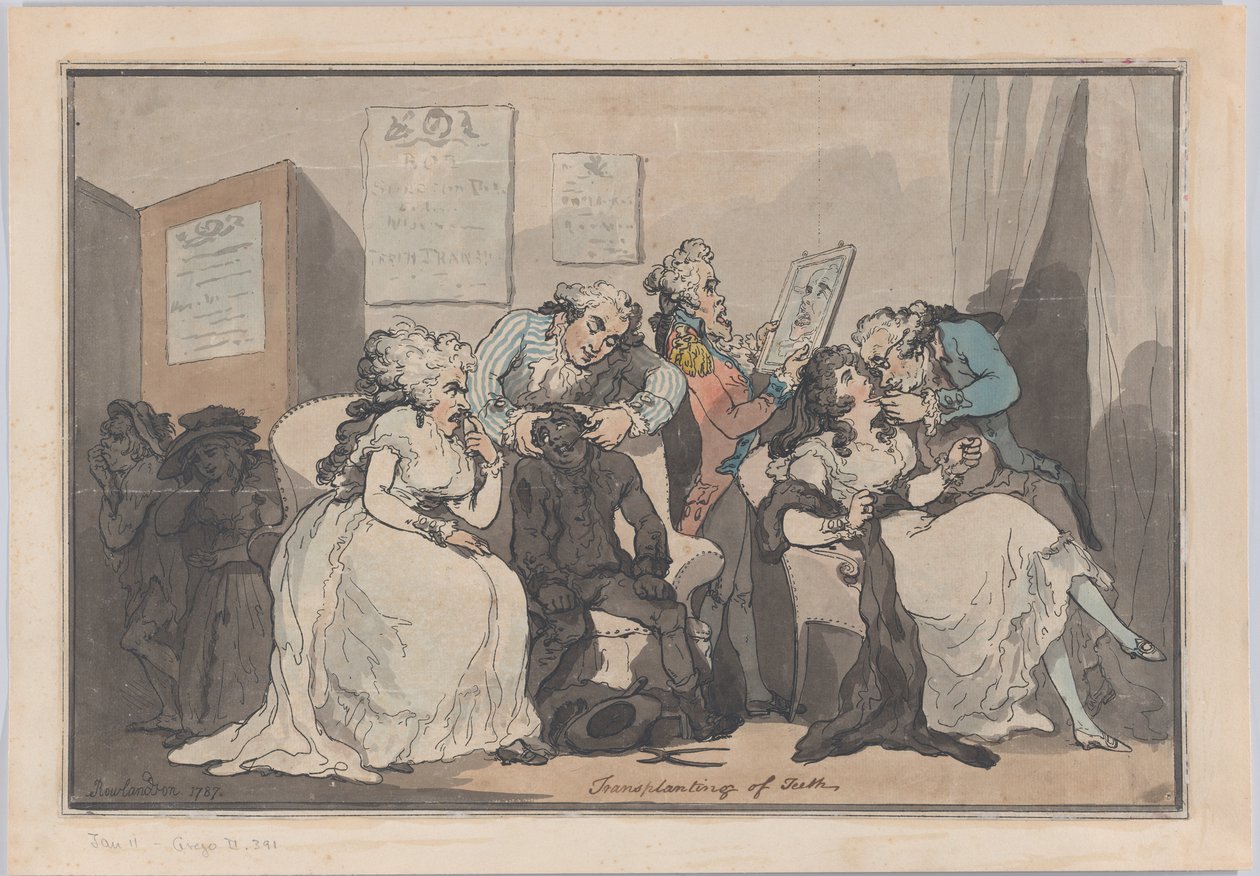 Transplantation de dents, 1787 - Thomas Rowlandson