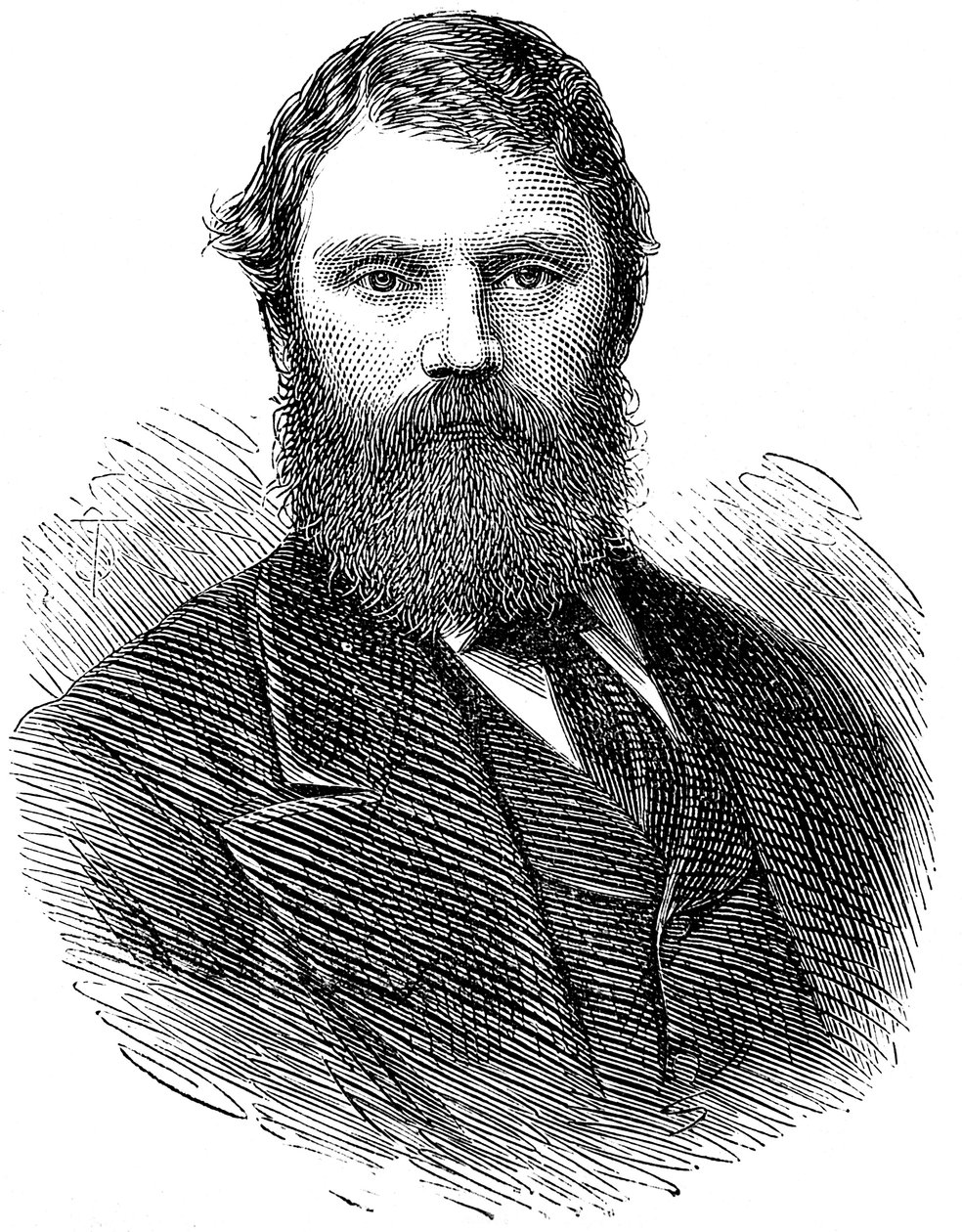 Francis Edmund Anstie 1833-1874, médecin anglais, 1874 - Unbekannt