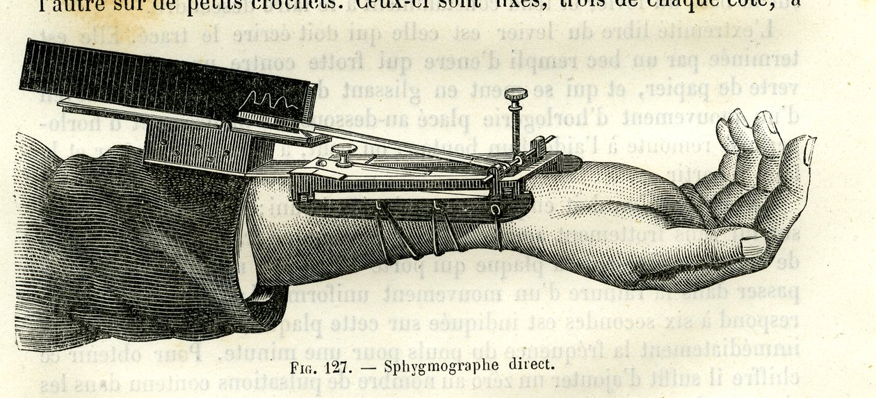 Sphygmographe direct - Unbekannter Künstler
