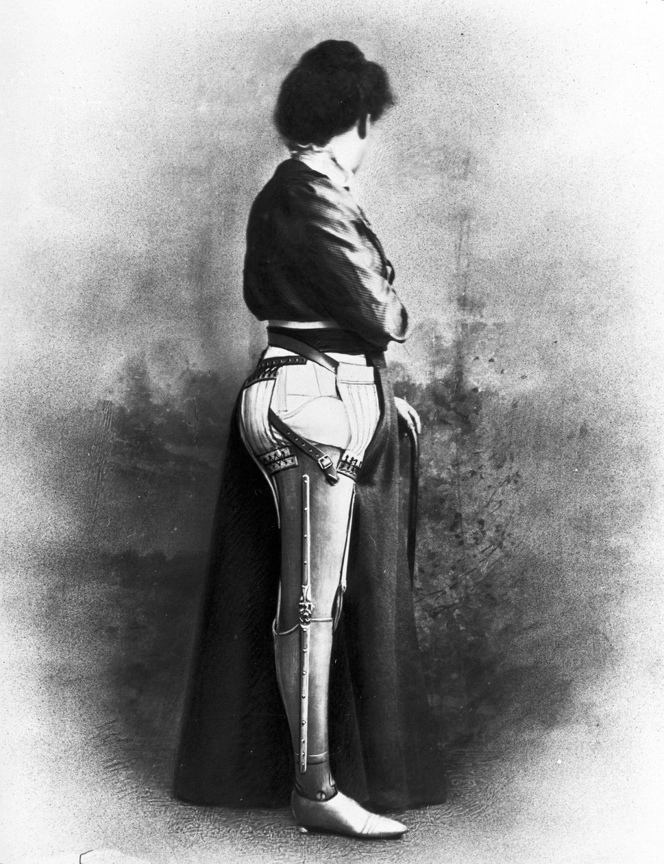 Prothèses Femme portant une jambe artificielle - Unbekannt