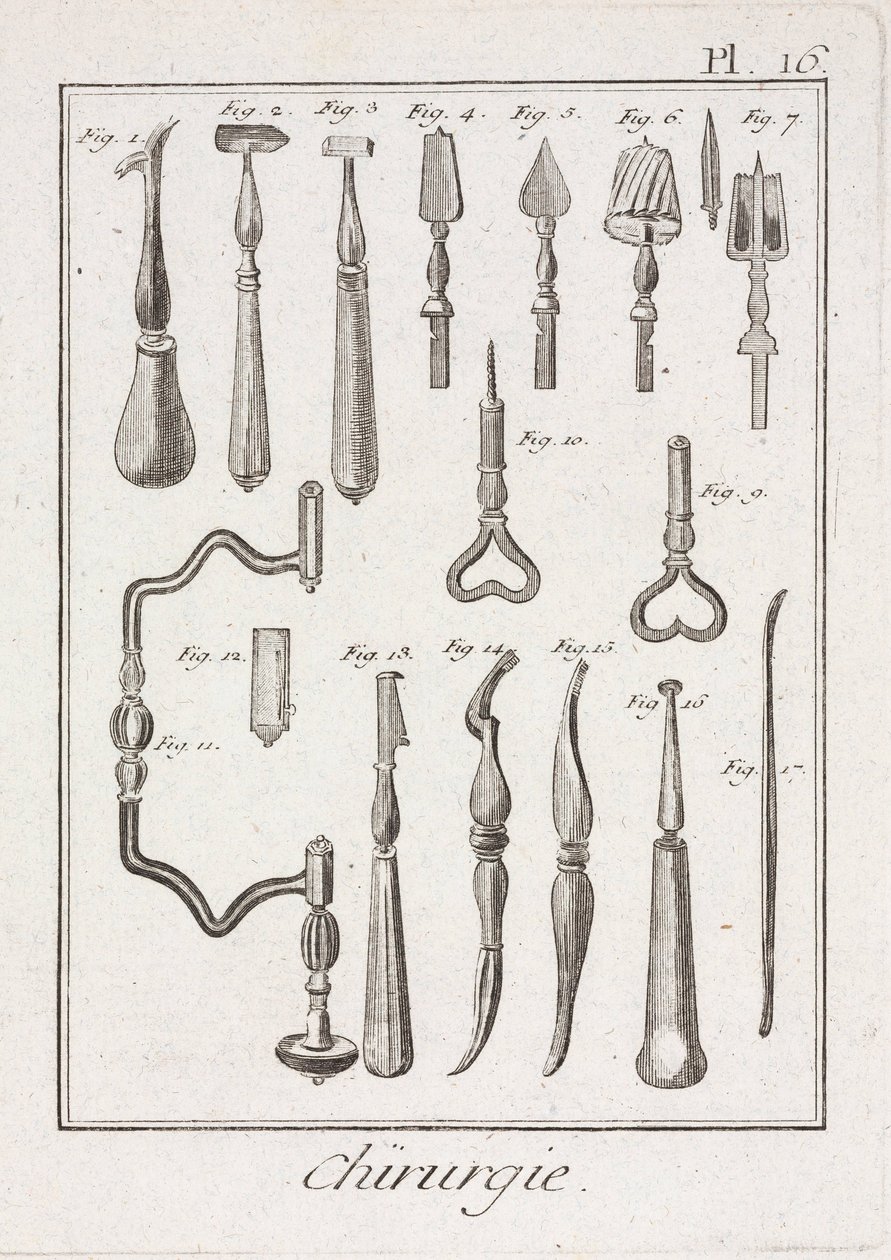 Trépanation Instruments de trépanation - Unbekannt