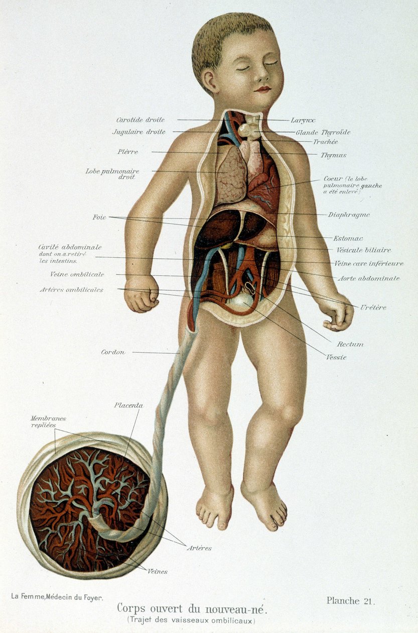 Médecine : nouveau-né (écorché au buste) - Unknown artist