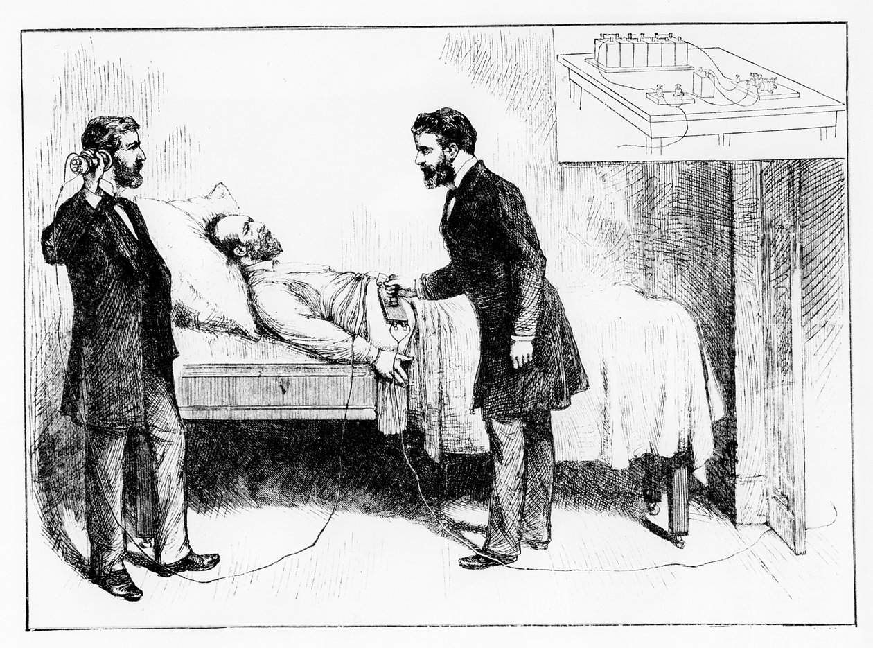 Le président Garfield (1831-1881) avec une balle non détectée en lui, 1881 - W. Shinkle