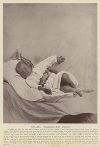 Calona, Bébé danseur soudanais