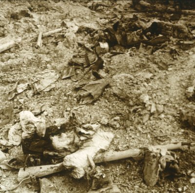 Restes humains, Verdun, nord de la France, vers 1914-1918 - Unbekannt