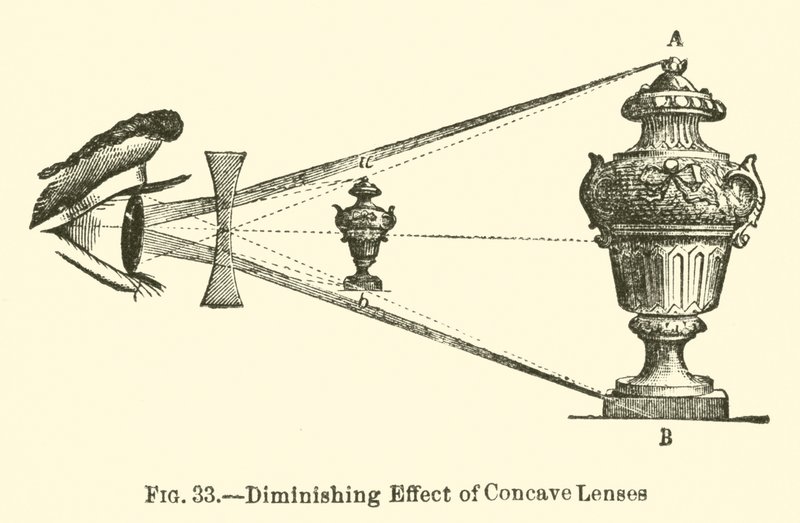 Effet Réducteur des Lentilles Concaves (gravure) - European School