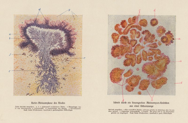 Actinomyces bovis - German School