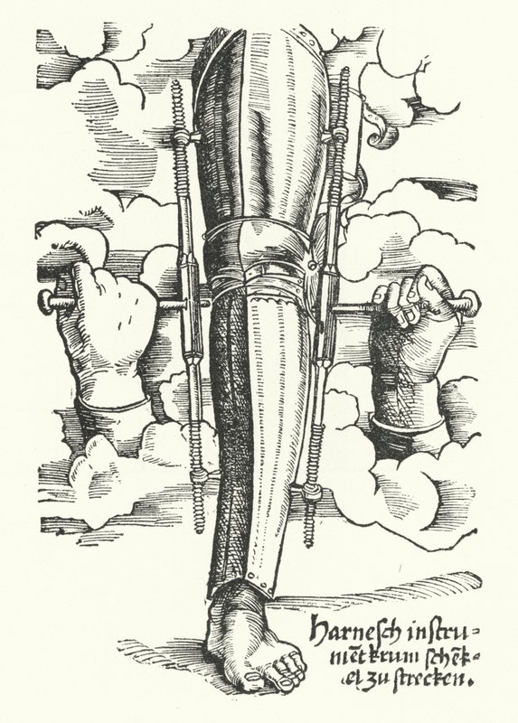 Dispositif pour redresser une jambe blessée - German School